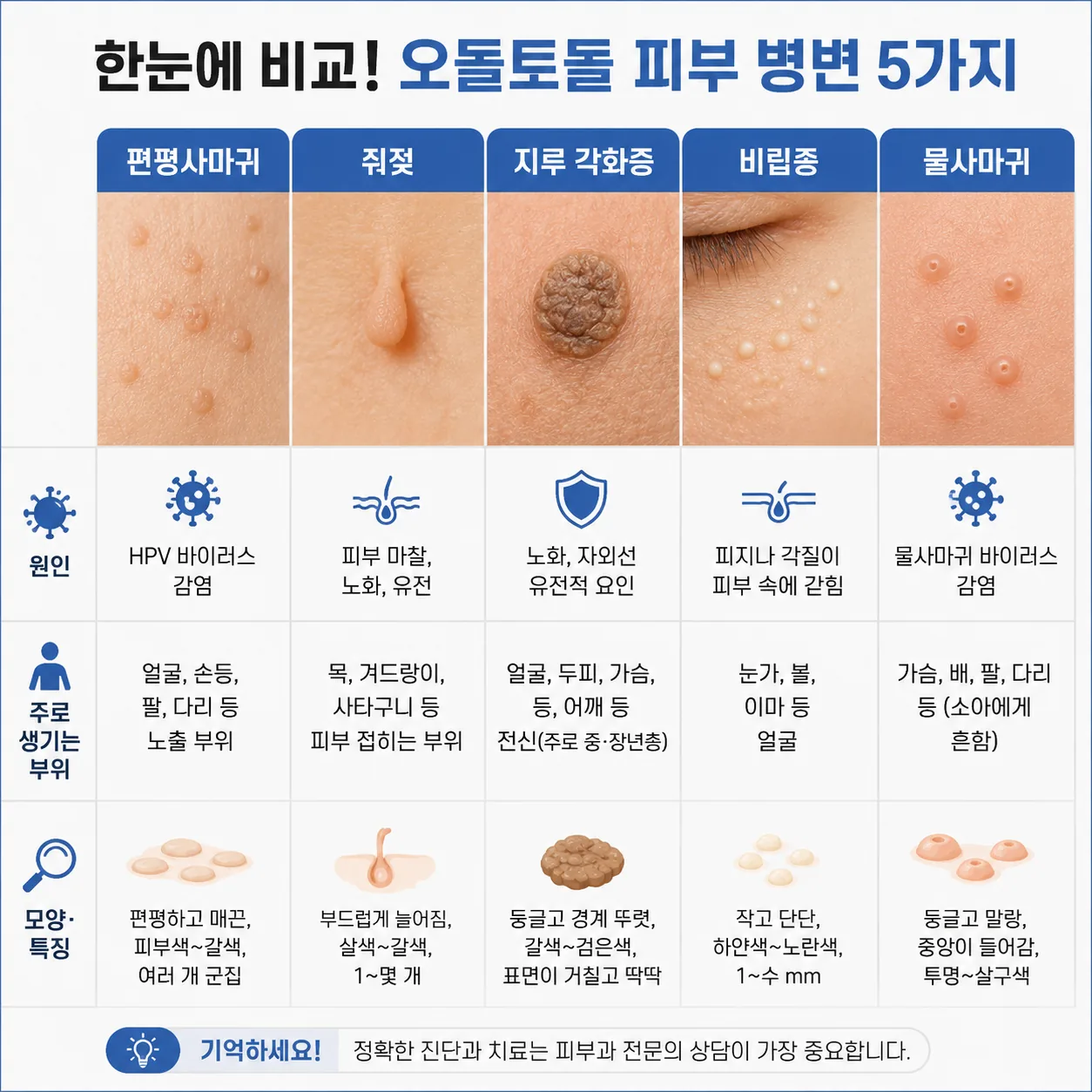 편평사마귀와 닮은 피부 병변들의 원인·부위·모양 비교 도식