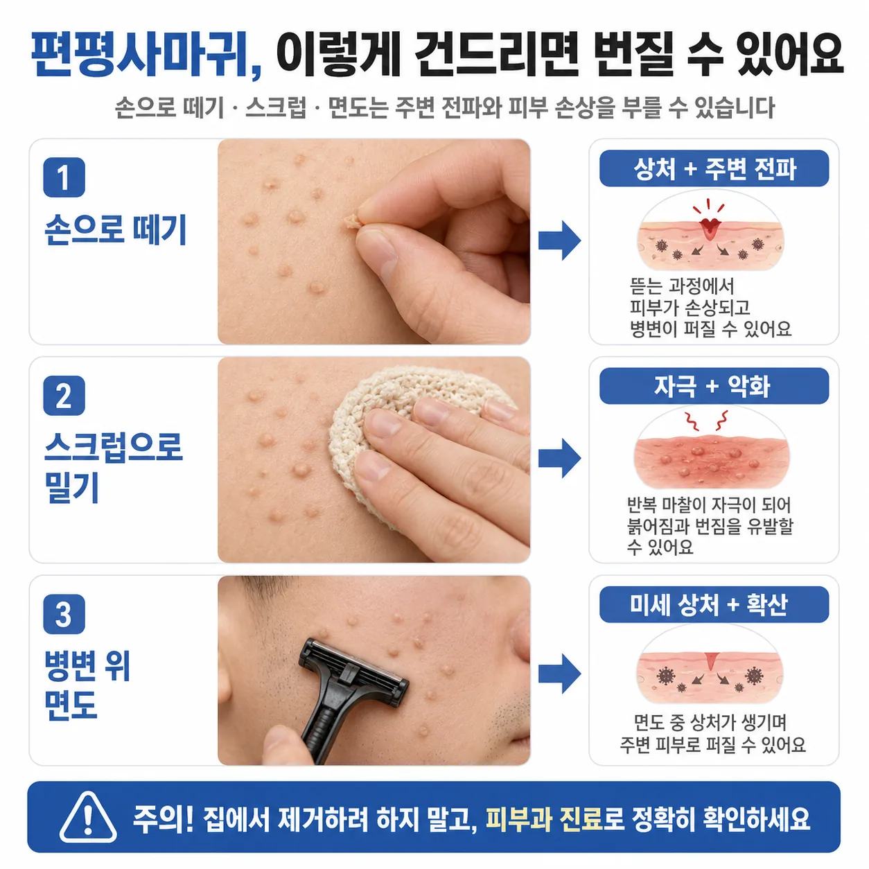 편평사마귀 자가 제거가 주변 전파와 피부 손상으로 이어지는 흐름 도식