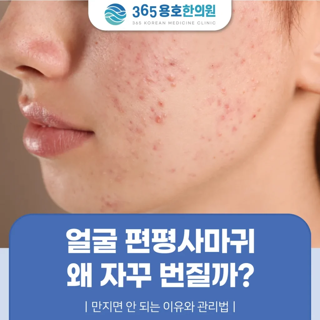 얼굴 편평사마귀, 왜 자꾸 번질까 — 만지면 안 되는 이유와 관리법