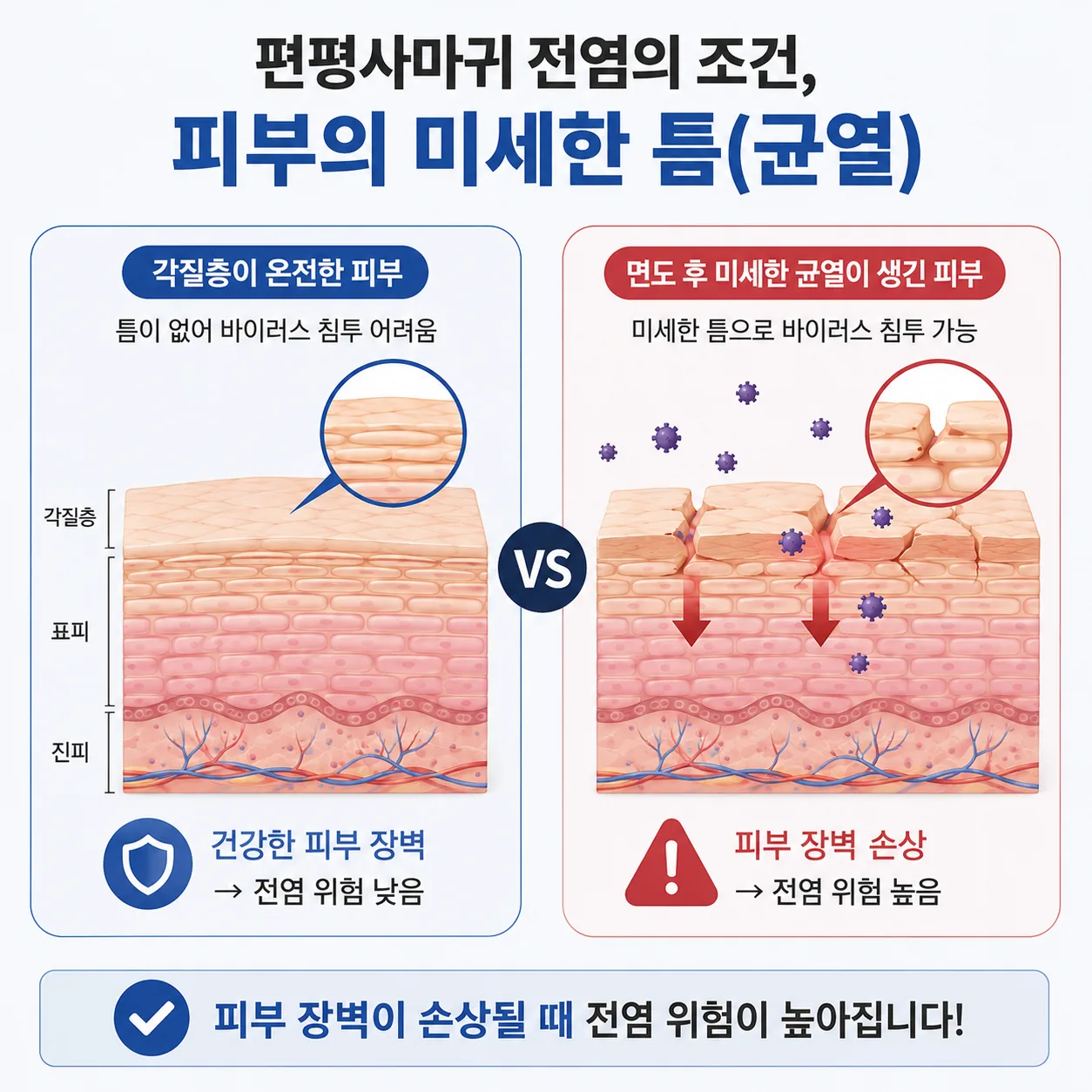 편평사마귀 전염 조건인 피부 각질층의 미세한 틈을 설명한 도해