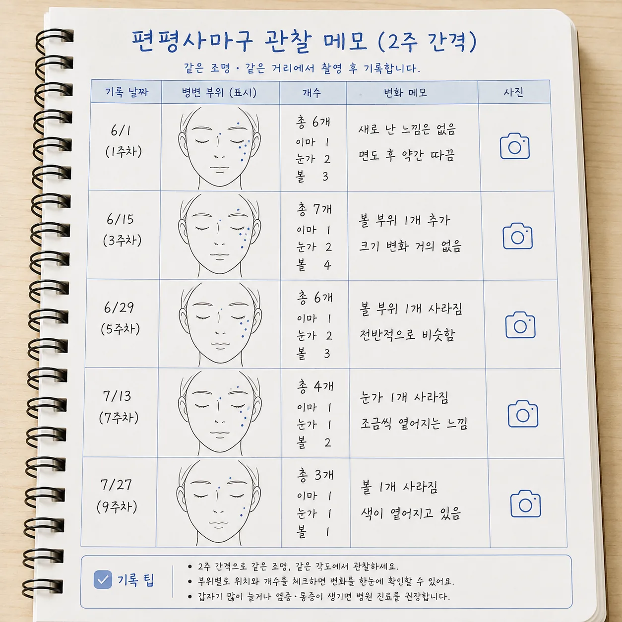 편평사마귀 개수와 부위를 2주 간격으로 기록한 관찰 메모 예시
