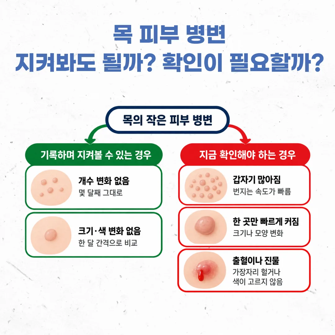 편평사마귀를 기록하며 지켜볼 상황과 진료로 확인할 상황을 나눈 갈림 도표