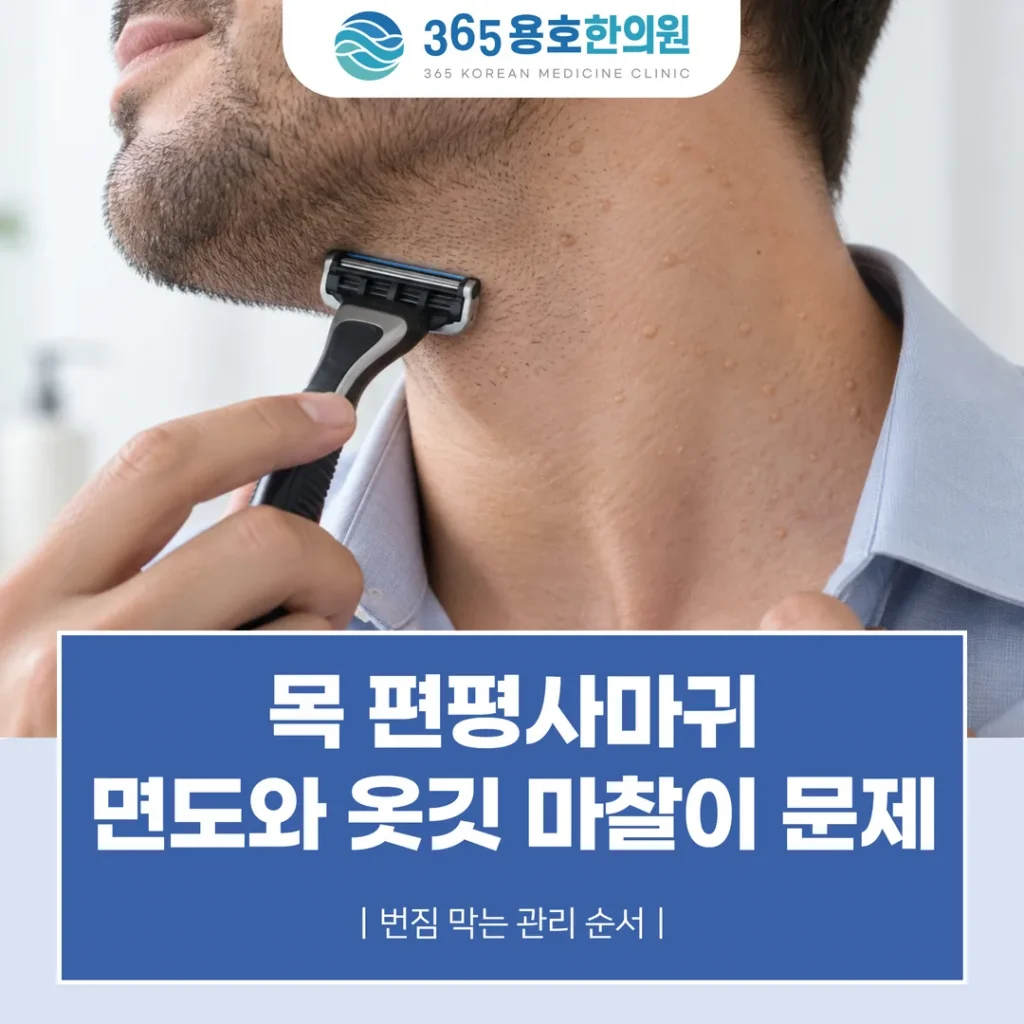 목 편평사마귀, 면도와 옷깃 마찰이 문제 — 번짐 막는 관리 순서